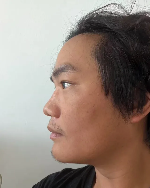 Alanzo